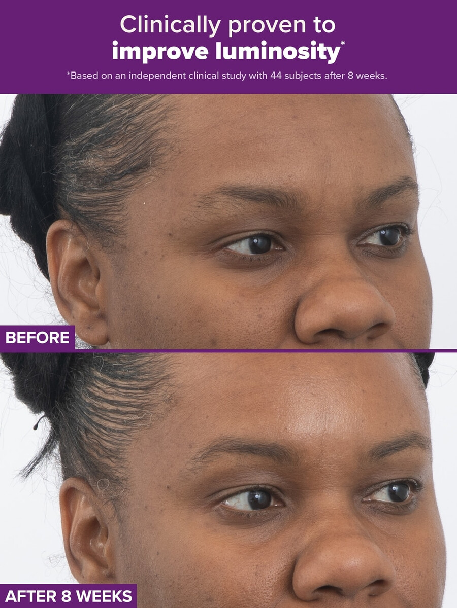 tratamiento dual con retinaldehído y retinoides clinical pro